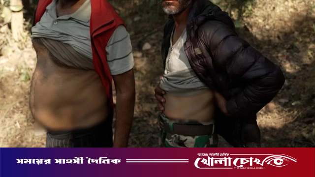 ‘কিডনি আবার গজাবে’ দালালের এমন কথায় যে গ্রাম হয়ে ওঠে ‘কিডনি ভ্যালি’