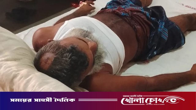 নগরকান্দায় চায়ের দোকানে অতর্কিত হামলা: হাতুড়ি ও ধারালো অস্ত্রের আঘাতে ব্যক্তি গুরুতর আহত