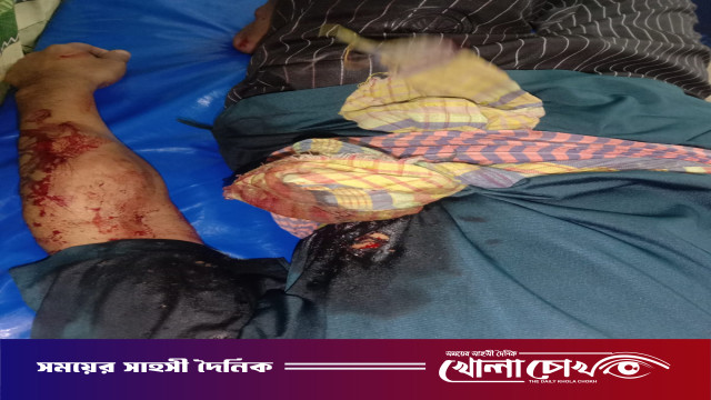 বেগমগঞ্জে দোকানে ঢুকে ব্যবসায়ীকে মুখোশধারীদের গুলি, আশঙ্কাজনক অবস্থায় ঢাকায় স্থানান্তর